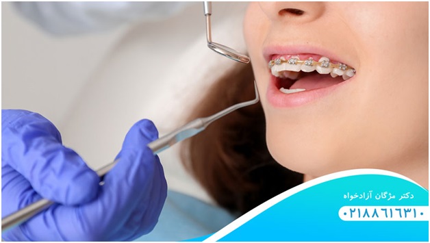 آشنایی با انواع روش های ترمیم دندان