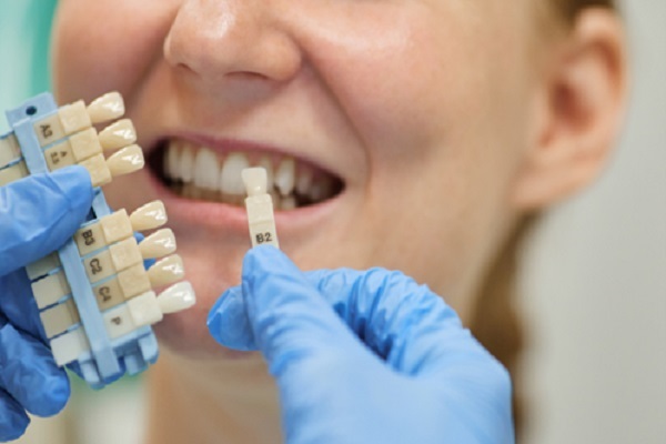 ایمپلنت دندان یا لمینت؟ کدام یک نتیجه بهتری دارد؟