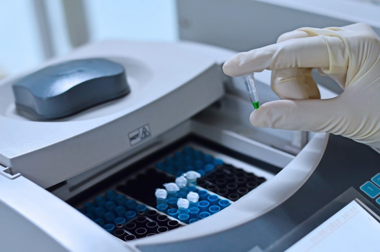 بررسی مواد ژنتیکی نمونه در تست PCR