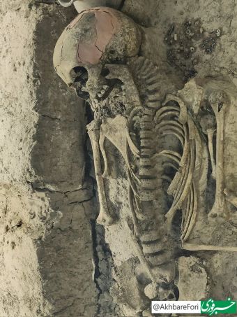 کشف اسکلت ۳۱۰۰ ساله یک دختربچه ۱۲ ساله در سگزآباد قزوین (عکس)