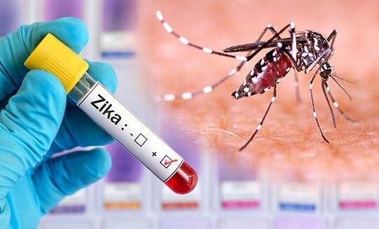 ویروس زیکا چیست؟ / علائم، راه های درمان و روش پیشگیری