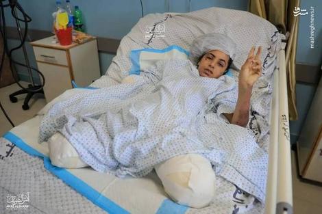دختر ۱۳ ساله فلسطینی در غزه : « پاهایم را میخواهم »