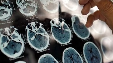 به این دلیل، پنیر بخورید