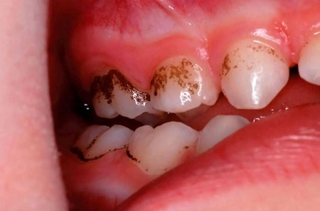 برای سلامت دندان ها اینها را بخور برای سلامت دندان ها اینها را بخور