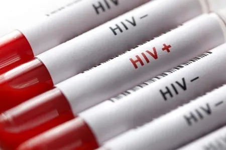 شناسایی 25000 مبتلا به HIV در ایران/ ایدز؛ از راه‌های پیشگیری تا درمان رایگان